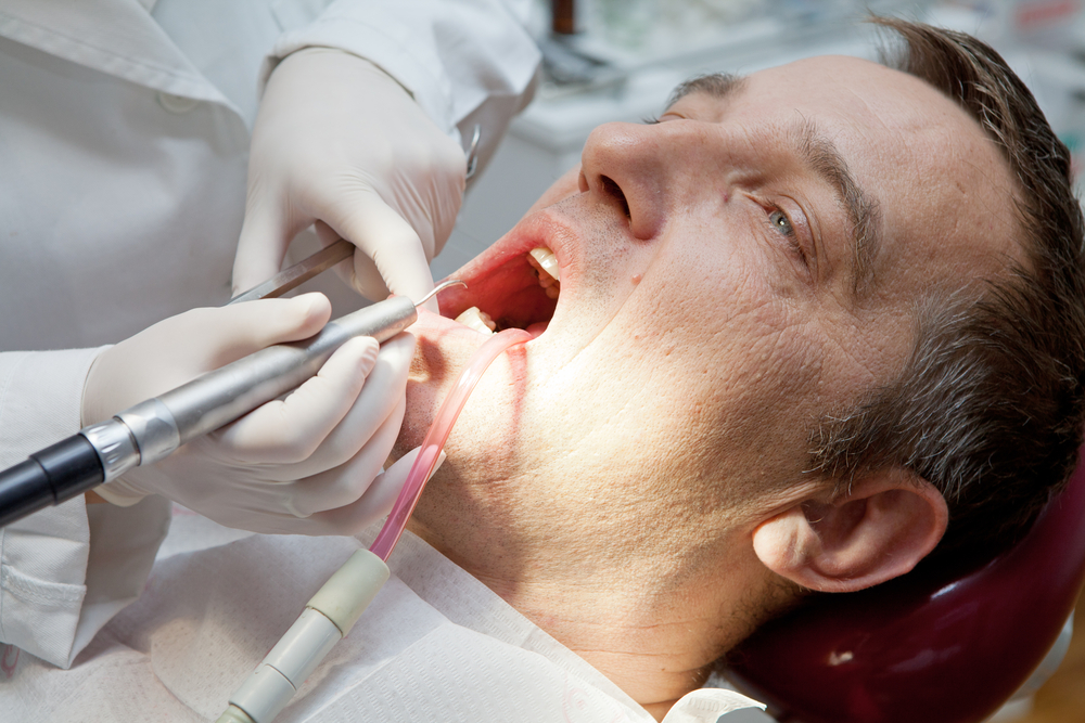 détartrage dents douloureux détartrage dents douloureux